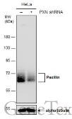 Anti-Paxillin antibody used in Western Blot (WB). GTX132155