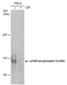 Anti-p130Cas (phospho Tyr165) antibody used in Western Blot (WB). GTX132160