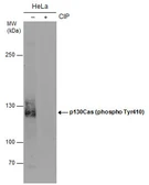 Anti-p130Cas (phospho Tyr410) antibody used in Western Blot (WB). GTX132162