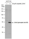 Anti-Chk1 (phospho Ser317) antibody used in Western Blot (WB). GTX132170