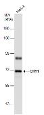 Anti-CRY1 antibody used in Western Blot (WB). GTX132177