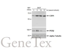 Anti-CRY1 antibody used in Western Blot (WB). GTX132177