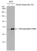 Anti-Chk2 (phospho Thr68) antibody used in Western Blot (WB). GTX132204
