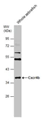 Anti-Cxcr4b antibody used in Western Blot (WB). GTX132244