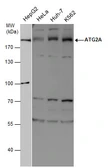 Anti-ATG2A antibody used in Western Blot (WB). GTX132260