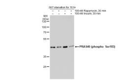 Anti-PRAS40 (phospho Ser183) antibody used in Western Blot (WB). GTX132277