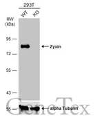Anti-Zyxin antibody used in Western Blot (WB). GTX132295