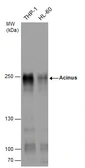 Anti-Acinus antibody used in Western Blot (WB). GTX132296