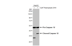 Anti-Caspase 12 antibody used in Western Blot (WB). GTX132298