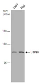 Anti-USP20 antibody used in Western Blot (WB). GTX132309