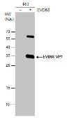 Anti-Enterovirus D68 VP1 antibody used in Western Blot (WB). GTX132312