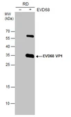 Anti-Enterovirus D68 VP1 antibody used in Western Blot (WB). GTX132312