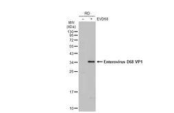 Anti-Enterovirus D68 VP1 antibody used in Western Blot (WB). GTX132313