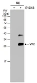 Anti-Enterovirus D68 VP2 antibody used in Western Blot (WB). GTX132314