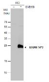 Anti-Enterovirus D68 VP3 antibody used in Western Blot (WB). GTX132315