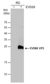 Anti-Enterovirus D68 VP3 antibody used in Western Blot (WB). GTX132315