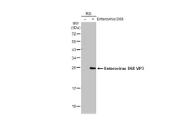 Anti-Enterovirus D68 VP3 antibody used in Western Blot (WB). GTX132315