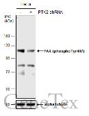 Anti-FAK (phospho Tyr407) antibody used in Western Blot (WB). GTX132320