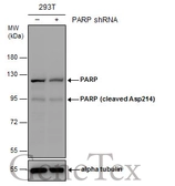 Anti-PARP antibody used in Western Blot (WB). GTX132329