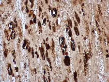 Anti-Enterovirus 71 VP1 antibody used in IHC (Paraffin sections) (IHC-P). GTX132338