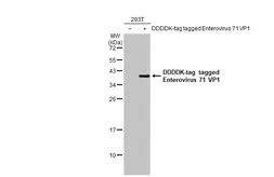 Anti-Enterovirus 71 VP1 antibody used in Western Blot (WB). GTX132338