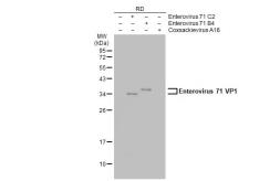 Anti-Enterovirus 71 VP1 antibody used in Western Blot (WB). GTX132339