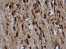 Anti-Enterovirus 71 VP2 antibody used in IHC (Paraffin sections) (IHC-P). GTX132340