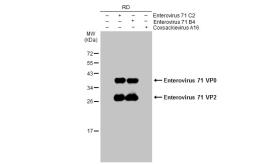 Anti-Enterovirus 71 VP2 antibody used in Western Blot (WB). GTX132340