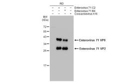 Anti-Enterovirus 71 VP2 antibody used in Western Blot (WB). GTX132340