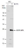 Anti-Enterovirus 71 VP3 antibody used in Western Blot (WB). GTX132341