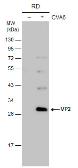 Anti-Coxsackievirus A6 VP2 antibody used in Western Blot (WB). GTX132347
