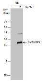 Anti-Coxsackievirus A6 VP2 antibody used in Western Blot (WB). GTX132348