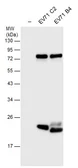 Anti-Enterovirus 71 3C antibody used in Western Blot (WB). GTX132357