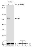 Anti-AXL antibody used in Western Blot (WB). GTX132386
