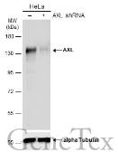 Anti-AXL antibody used in Western Blot (WB). GTX132387