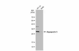 Anti-Aquaporin 5 antibody used in Western Blot (WB). GTX132400