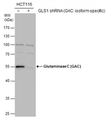 Anti-Glutaminase C (GAC) antibody used in Western Blot (WB). GTX132402