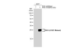 Anti-RAS (G12D Mutant) antibody used in Western Blot (WB). GTX132407