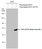 Anti-AKT3 (E17K Mutant Specific) antibody used in Western Blot (WB). GTX132417