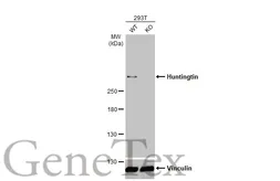 Anti-Huntingtin antibody used in Western Blot (WB). GTX132433