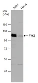 Anti-PYK2 antibody used in Western Blot (WB). GTX132447