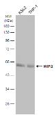 Anti-WIPI2 antibody used in Western Blot (WB). GTX132453