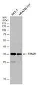 Anti-TRADD antibody used in Western Blot (WB). GTX132467