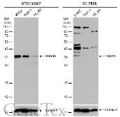 Anti-TRADD antibody used in Western Blot (WB). GTX132467