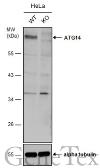 Anti-ATG14 antibody used in Western Blot (WB). GTX132468