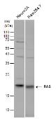 Anti-RAS antibody used in Western Blot (WB). GTX132480