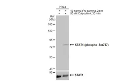 Anti-STAT1 (phospho Ser727) antibody used in Western Blot (WB). GTX132507