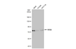 Anti-VISA antibody used in Western Blot (WB). GTX132522