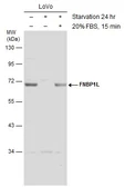 Anti-FNBP1L antibody used in Western Blot (WB). GTX132527