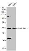 Anti-TGF beta 2 antibody used in Western Blot (WB). GTX132546